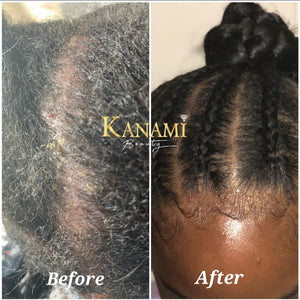 Kanami Beauty's Crown Creme